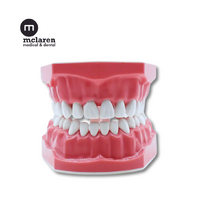 McLaren Dental Standard 1:1 Adult Dental Typodont Study Model