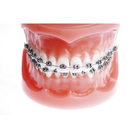 Orthodontics